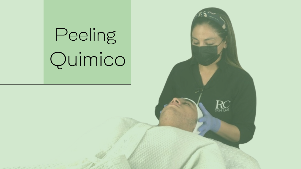 Peeling Químico