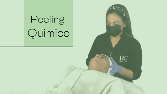 Peeling Químico